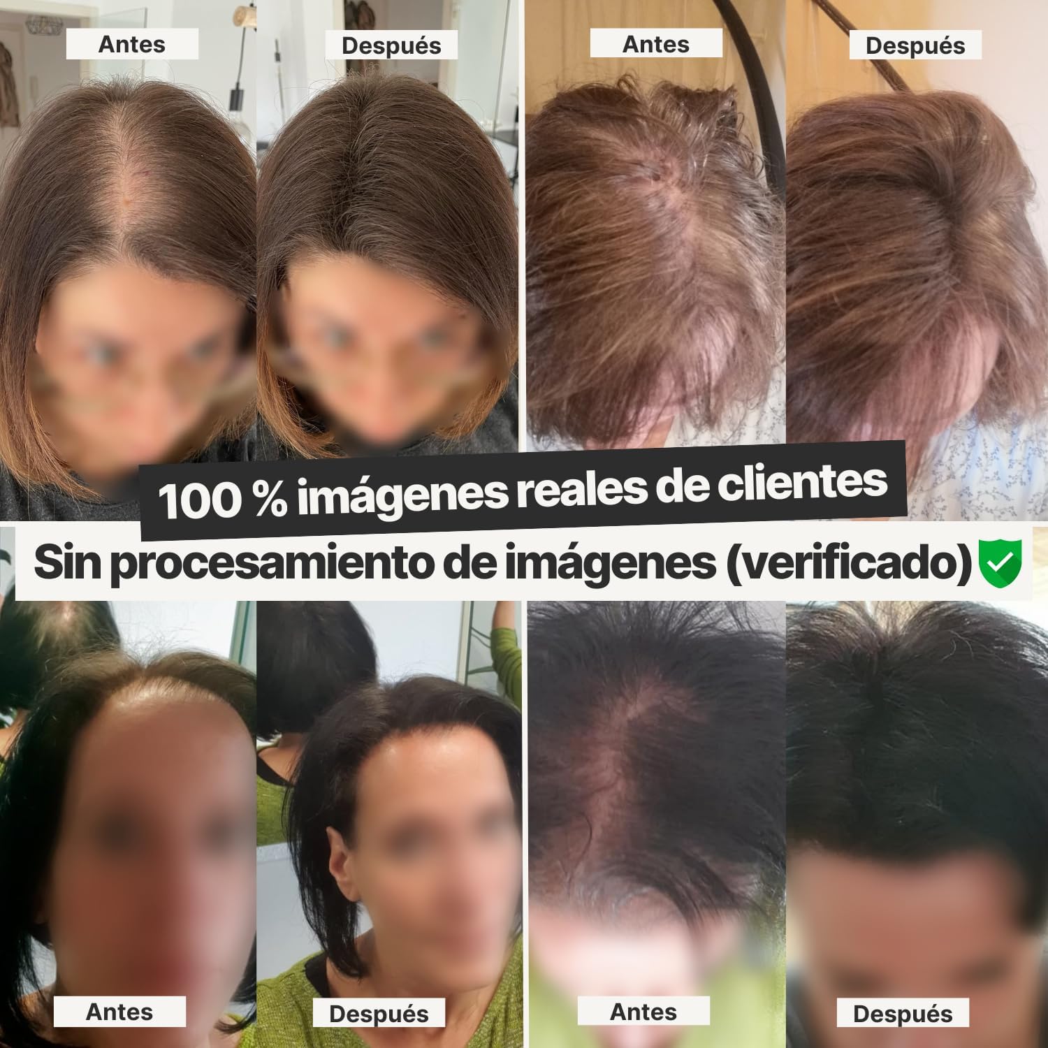 HairVit™ - Polvo de Fibra Capilar (Oculta Clareos y Pelo Fino)