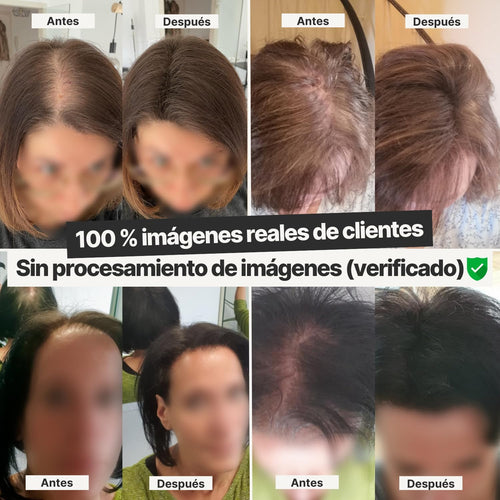 HairVit™ - Polvo de Fibra Capilar (Oculta Clareos y Pelo Fino)